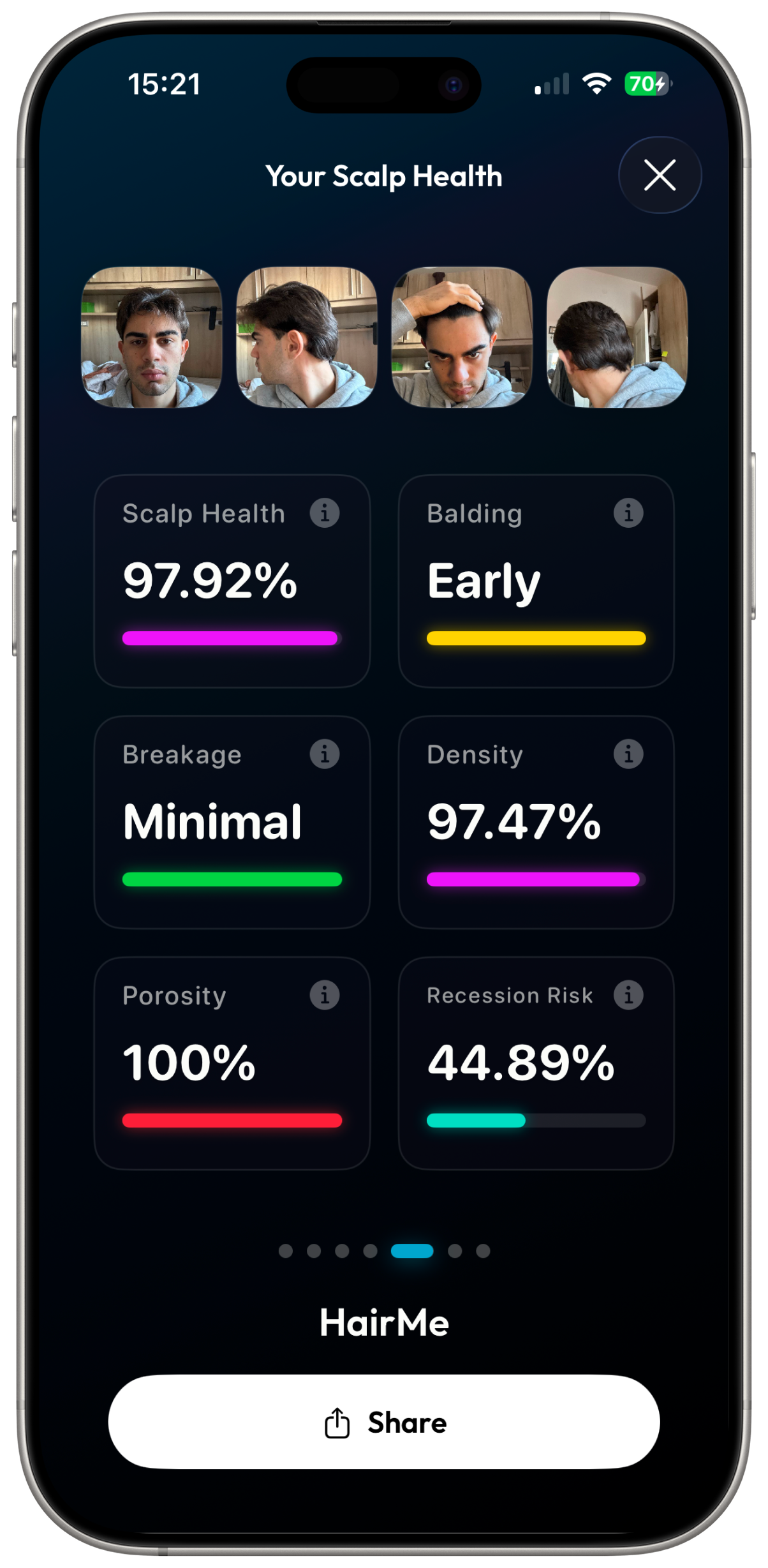 See how healthy your hair is